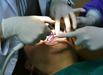 Dental care check up, Dentist examining and doing teeth treatment in dental clinic, Yearly visit for teeth cleaning and scaling to prevent gum disease problems, Healthy oral hygienic.